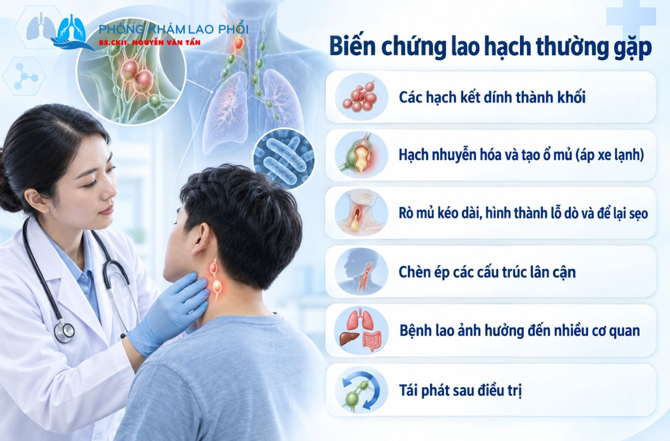 Biến chứng lao hạch có thể gồm áp xe lạnh, rò mủ, chèn ép cấu trúc lân cận và tái phát