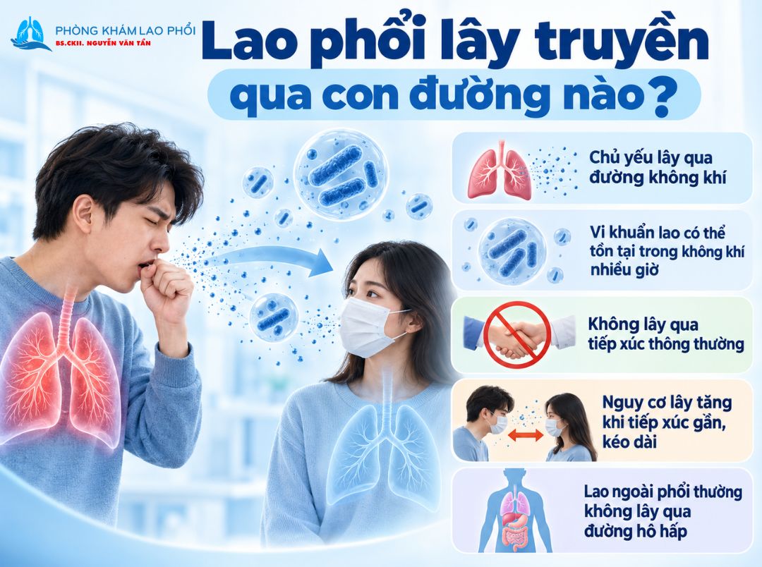 Lao phổi lây truyền chủ yếu qua đường không khí