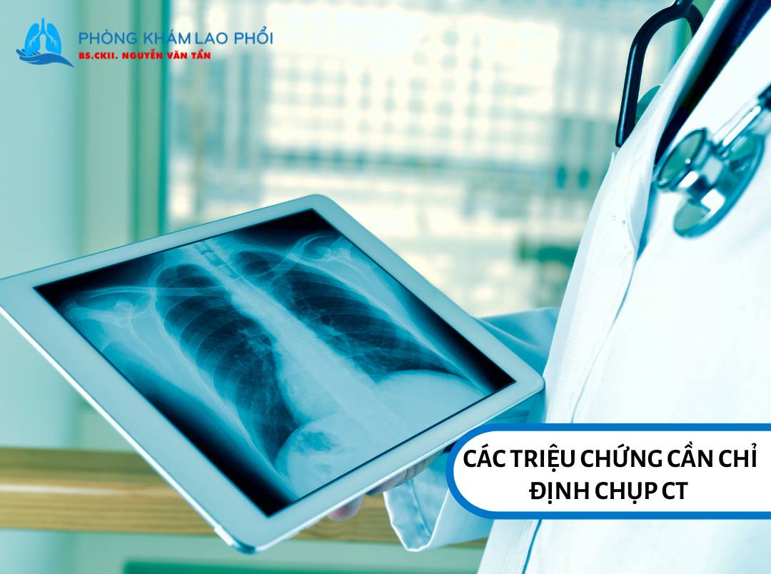 Các triệu chứng cần chỉ định chụp CT