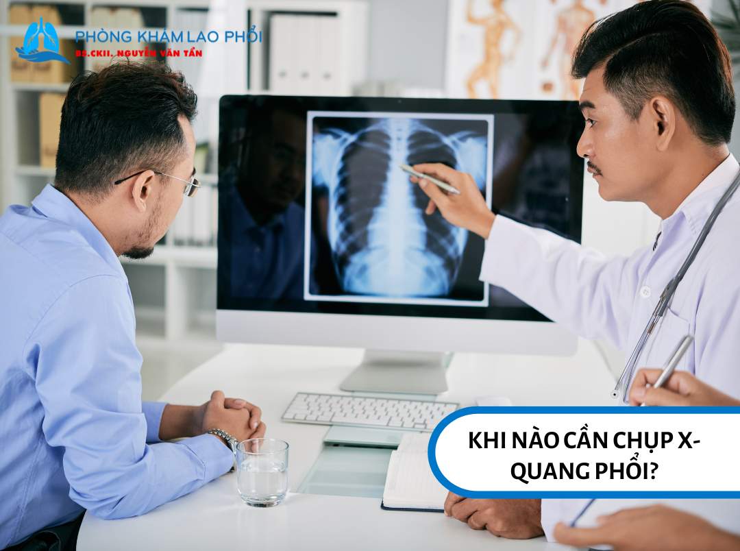 Chụp X-quang phổi thường được bác sĩ chỉ định trong nhiều tình huống lâm sàng