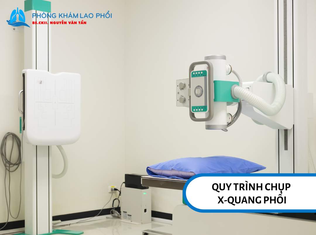 Máy chụp X-quang phổi