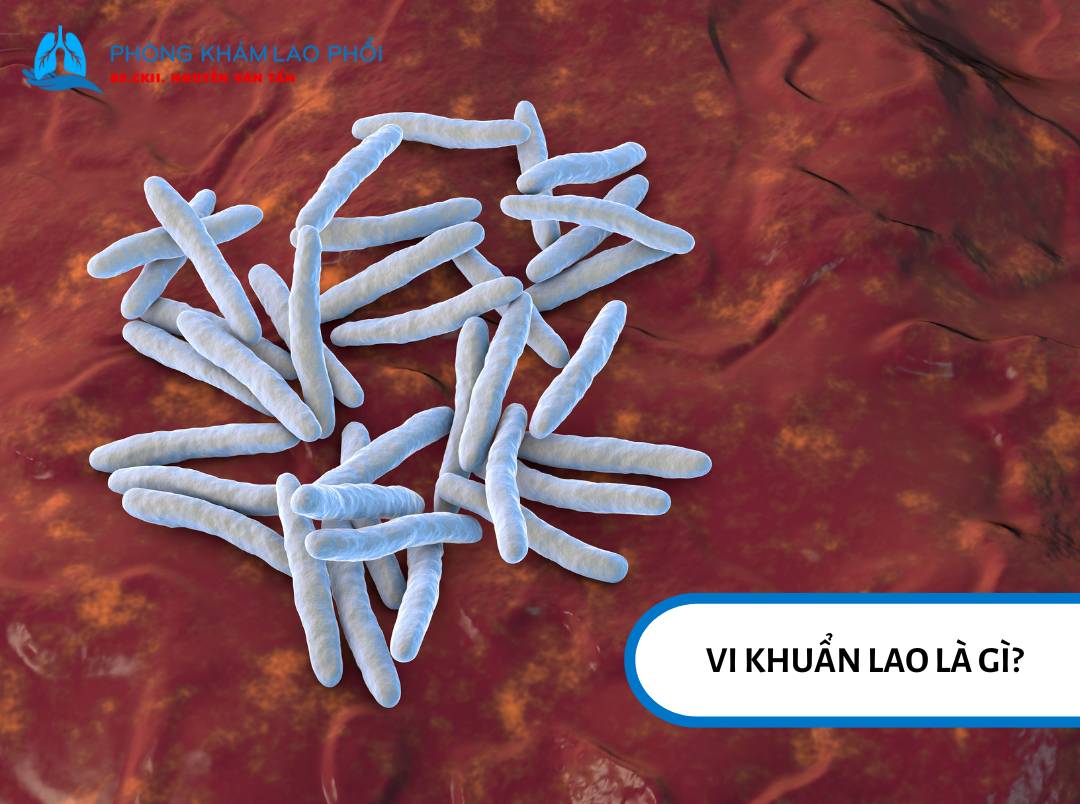 Vi khuẩn lao có dạng que nhỏ, thẳng hoặc hơi cong
