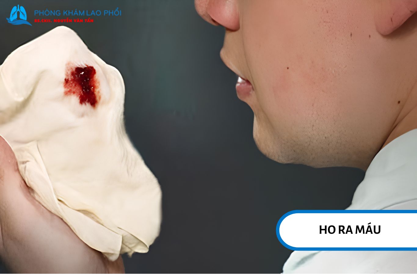 Ho kéo dài, khạc đờm, đau ngực và khó thở là các triệu chứng hô hấp thường gặp của lao phổi