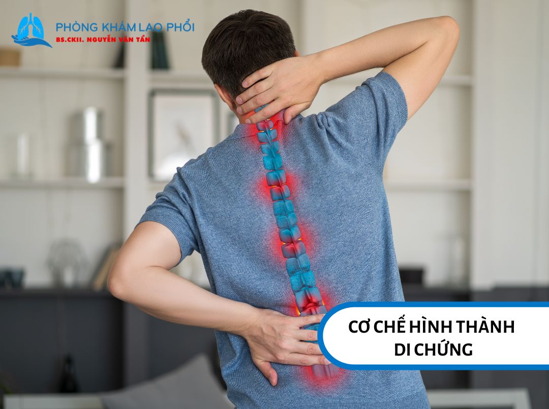 Cơ chế hình thành di chứng lao xương khớp 