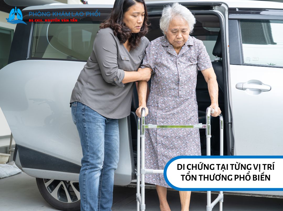 Khả năng vận động của người bệnh có thể bị giảm