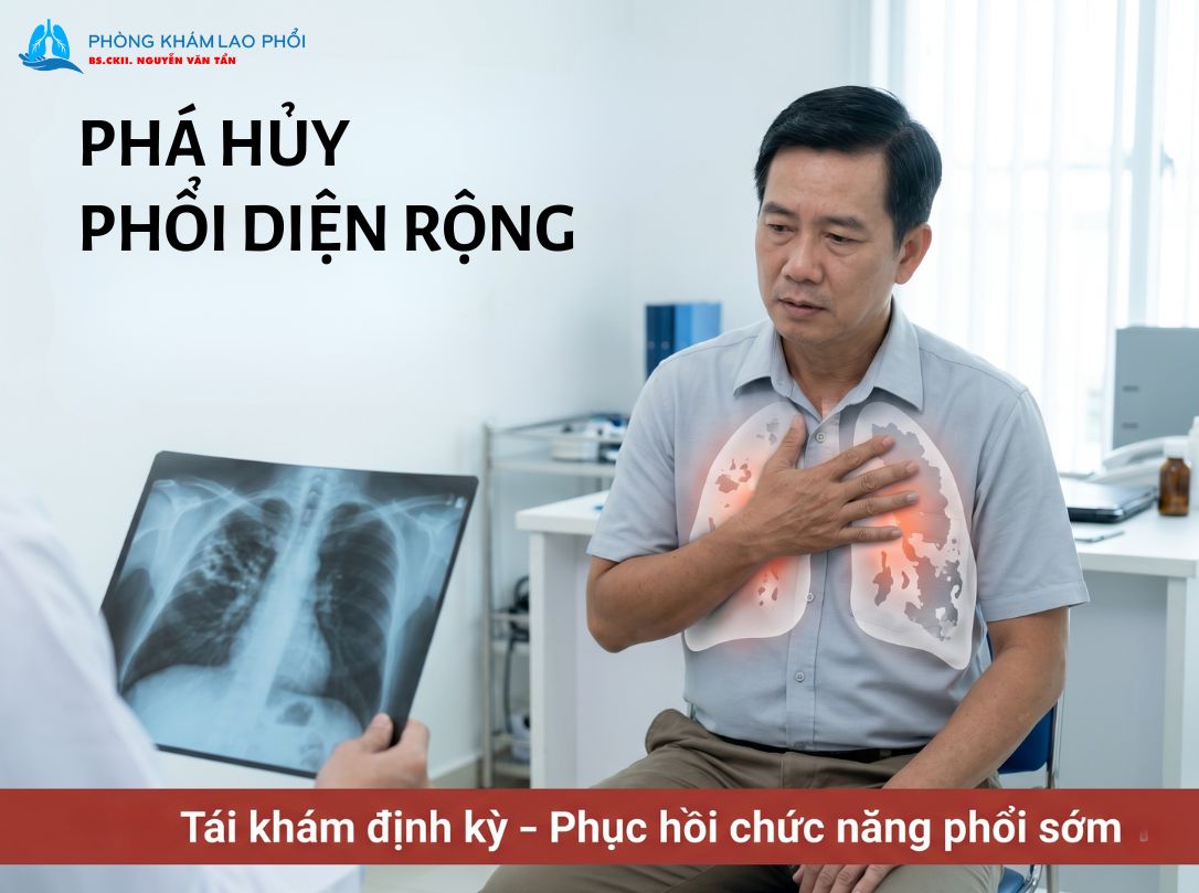 Đây là tình trạng nhu mô phổi bị tổn thương mất cấu trúc nghiêm trọng