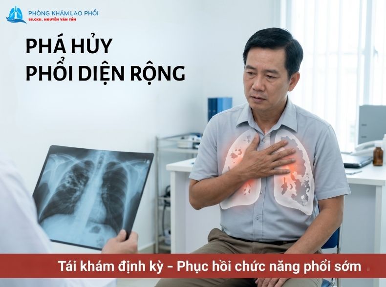 Đây là tình trạng nhu mô phổi bị tổn thương mất cấu trúc nghiêm trọng