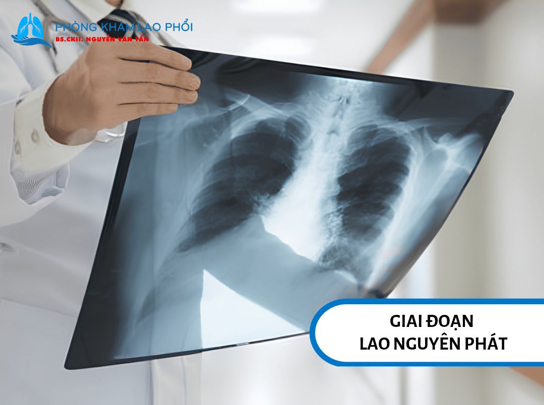 Giai đoạn phơi nhiễm thường không có triệu chứng biểu hiện rõ ràng 