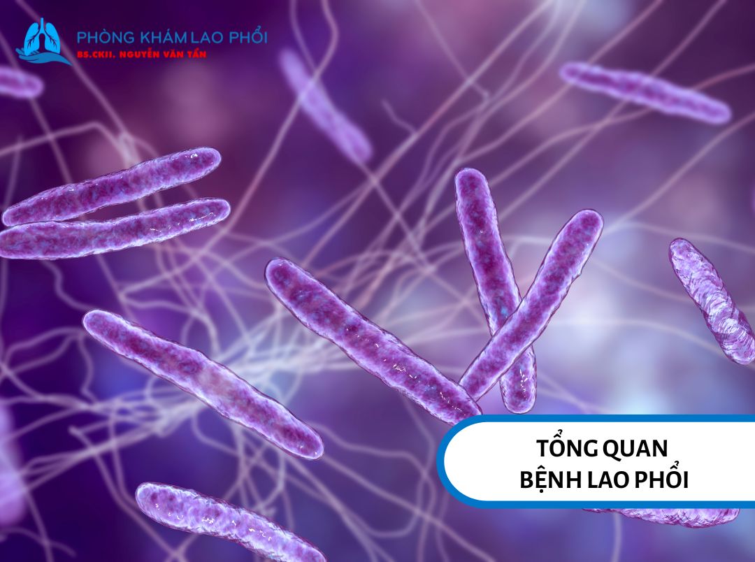Hình ảnh vi khuẩn Mycobacterium tuberculosis