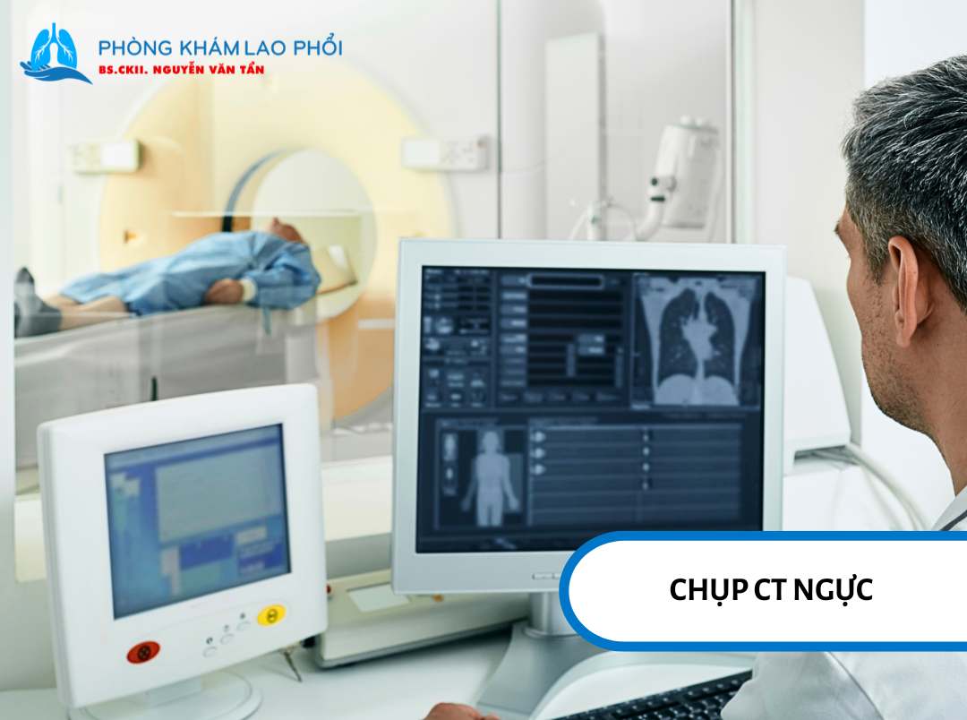 CT ngực cho hình ảnh rõ nét và chi tiết hơn