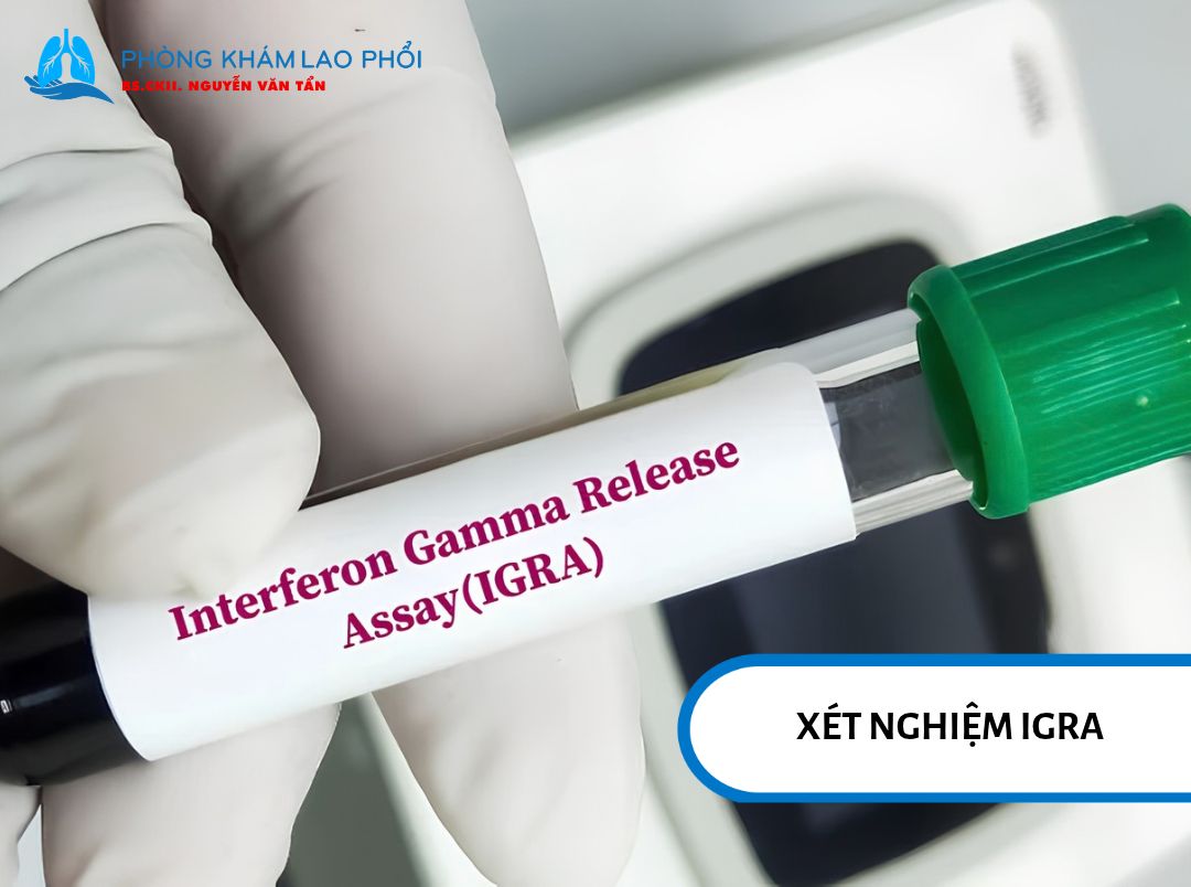 Xét nghiệm vi khuẩn lao qua máu có độ đặc hiệu cao trên 95%