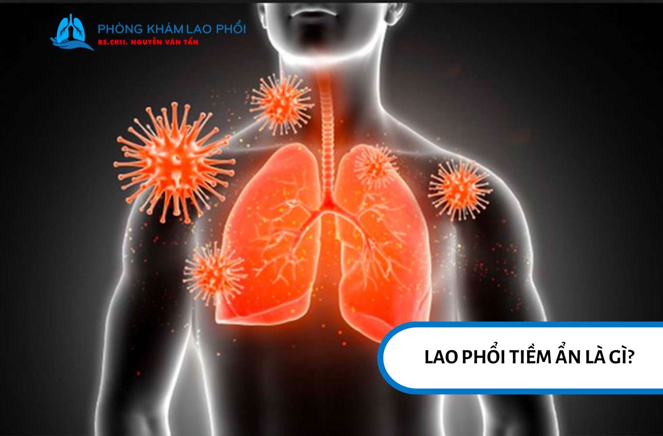 Lao tiềm ẩn là tình trạng có vi khuẩn lao xâm nhập vào cơ thể nhưng chưa phát bệnh