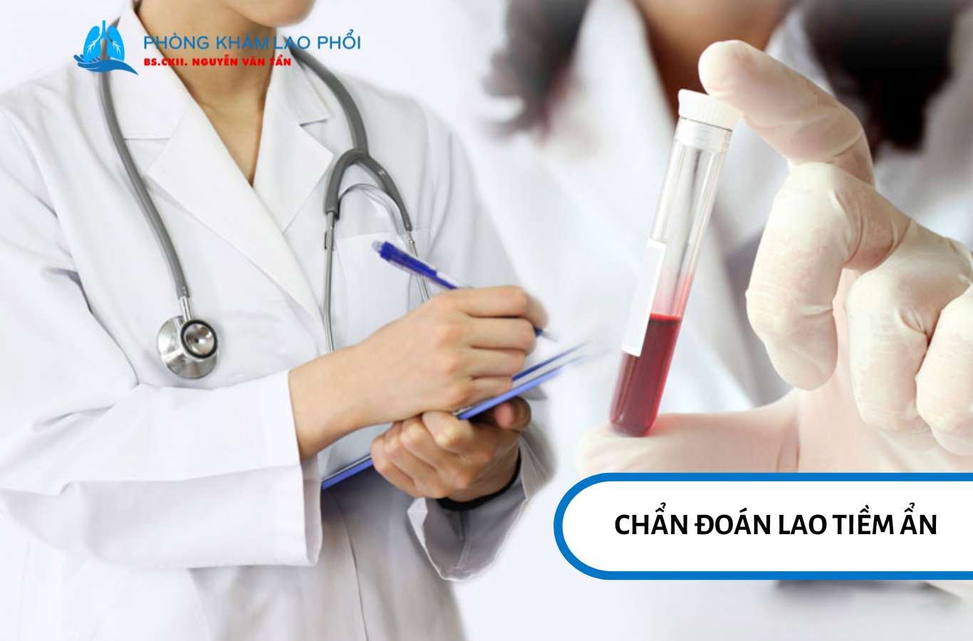 Bác sĩ chẩn đoán lao tiềm ẩn qua test Mantoux hoặc xét nghiệm IGRA