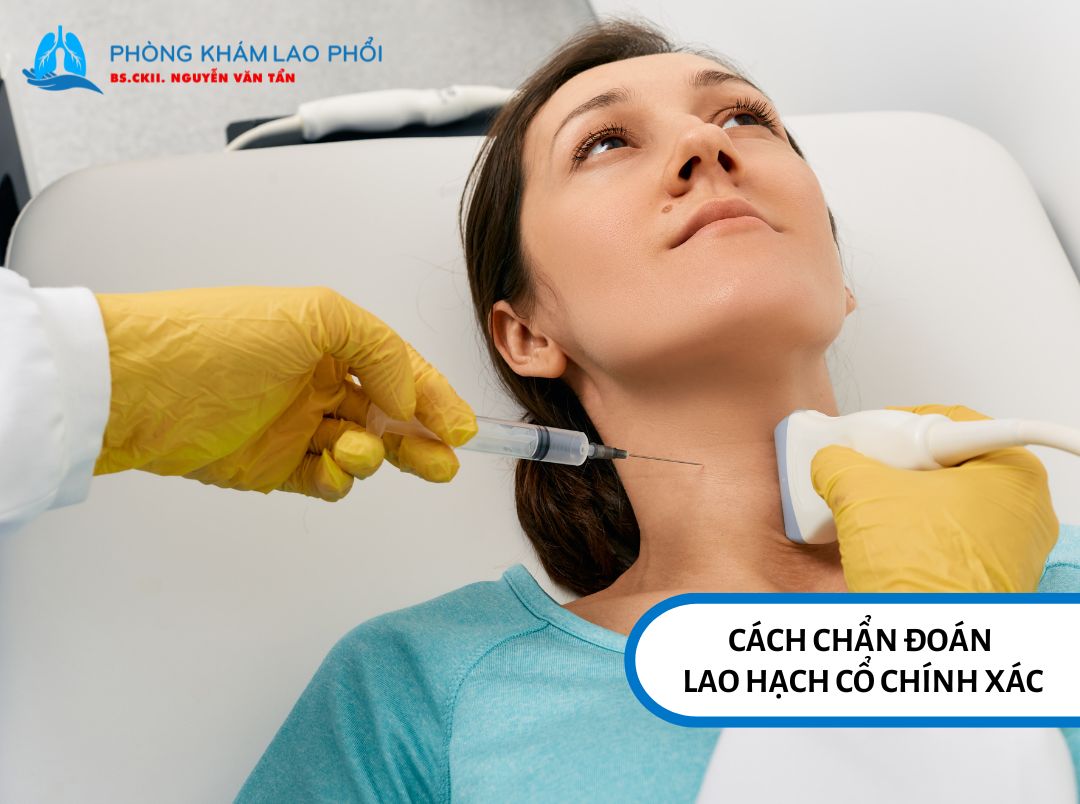 Chọc hút kim nhỏ là phương pháp được ưu tiên hàng đầu trong chẩn đoán lao hạch cổ