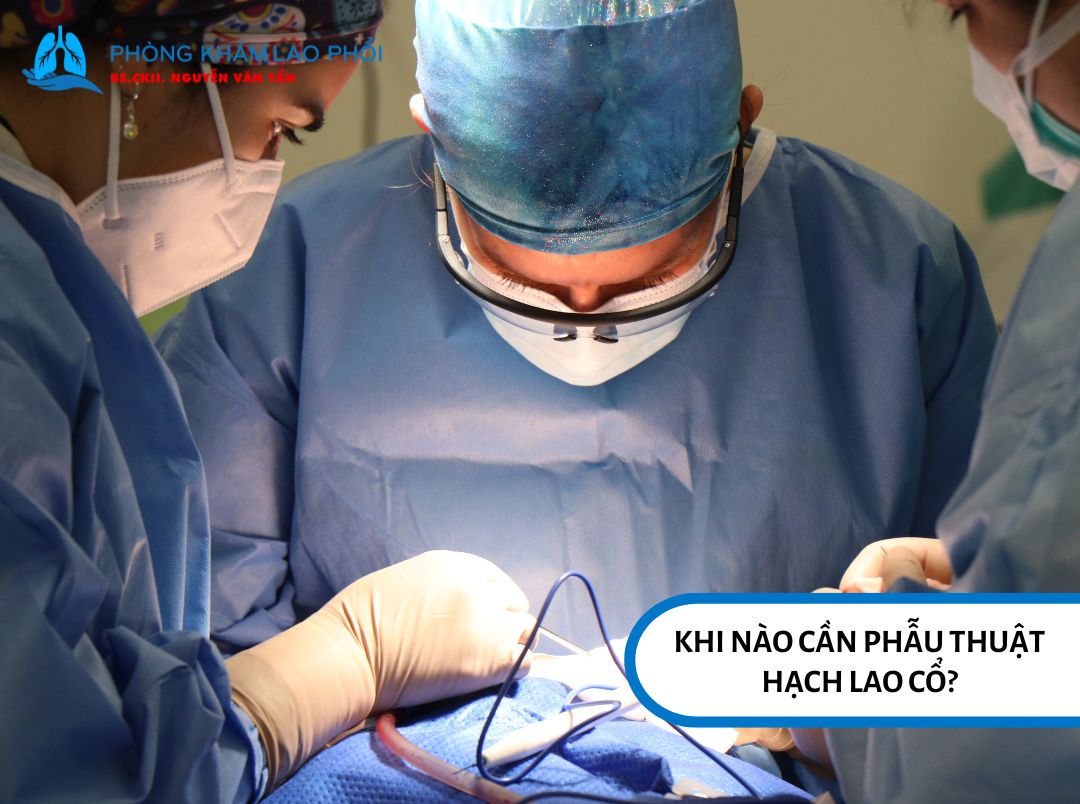 Phẫu thuật hạch lao cổ thường được chỉ định khi người bệnh xuất hiện biến chứng tại hạch