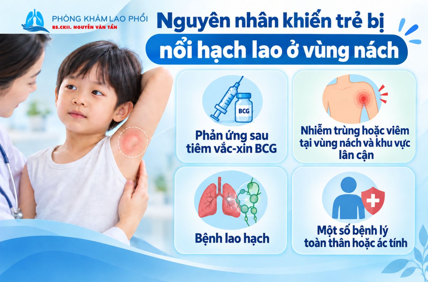Hạch nách ở trẻ có thể do tiêm BCG, nhiễm trùng hoặc lao hạc