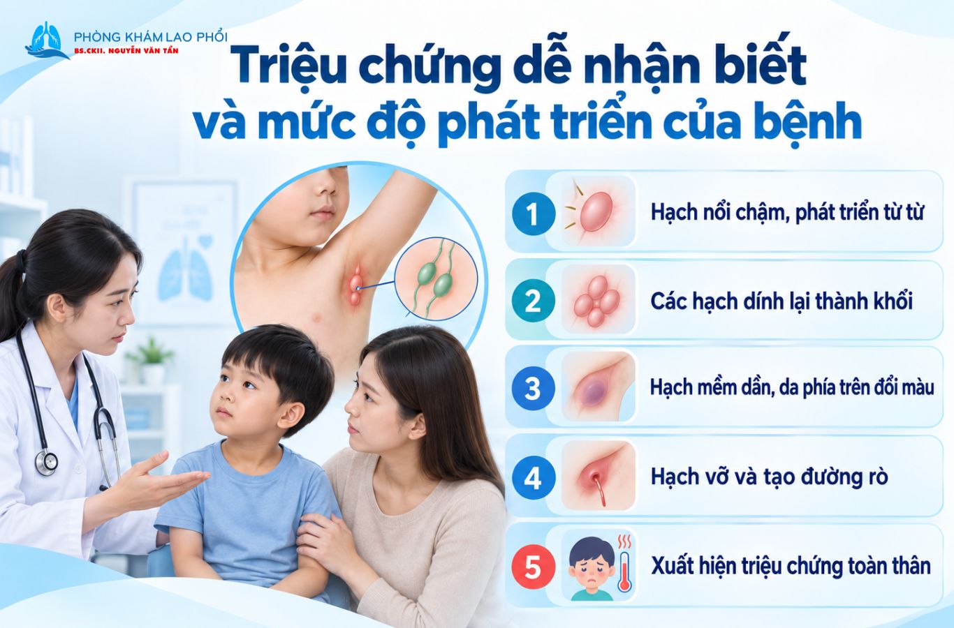 Lao hạch nách ở trẻ thường tiến triển từ hạch nhỏ, chắc đến hóa mủ và tạo đường rò