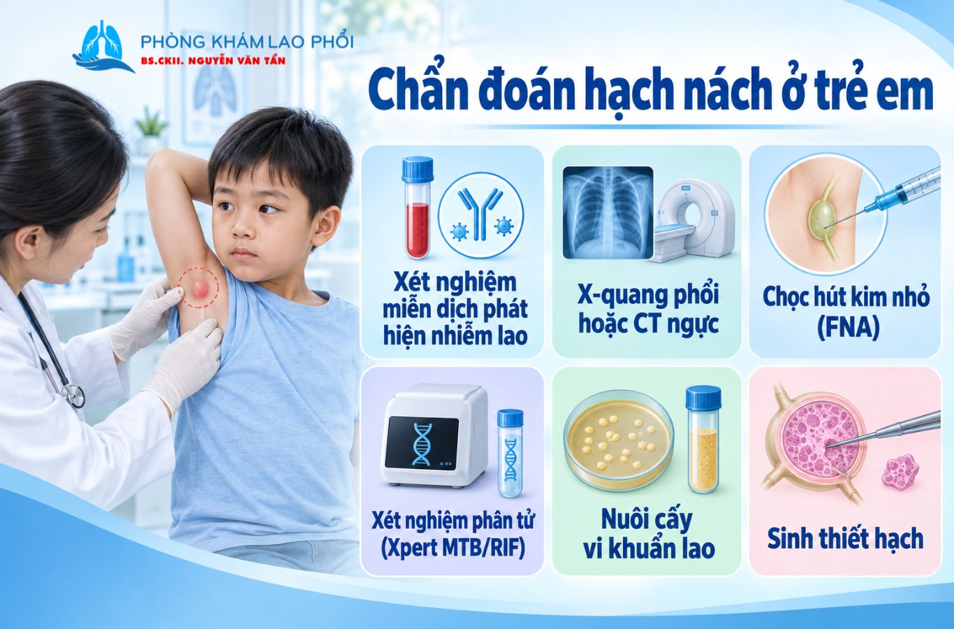  Các xét nghiệm giúp chẩn đoán và xác định lao hạch nách ở trẻ em