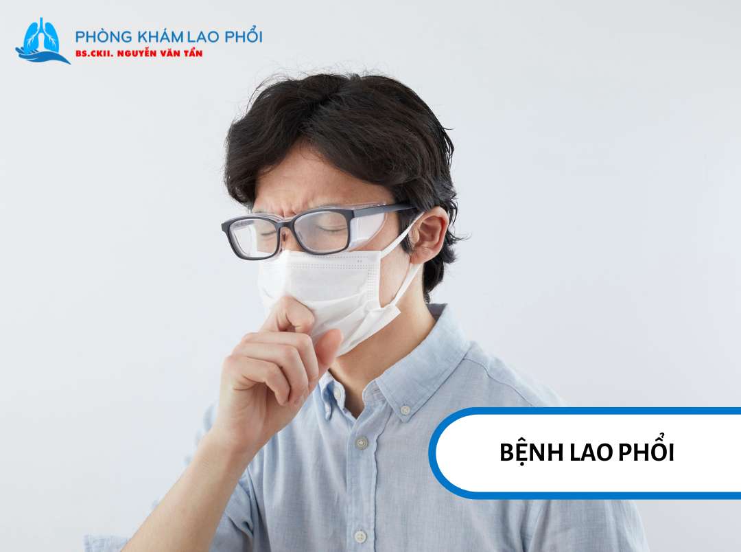 Theo thống kê năm 2023, toàn cầu có khoảng 10,8 triệu ca mắc mới và gần 1,25 triệu người tử vong vì lao