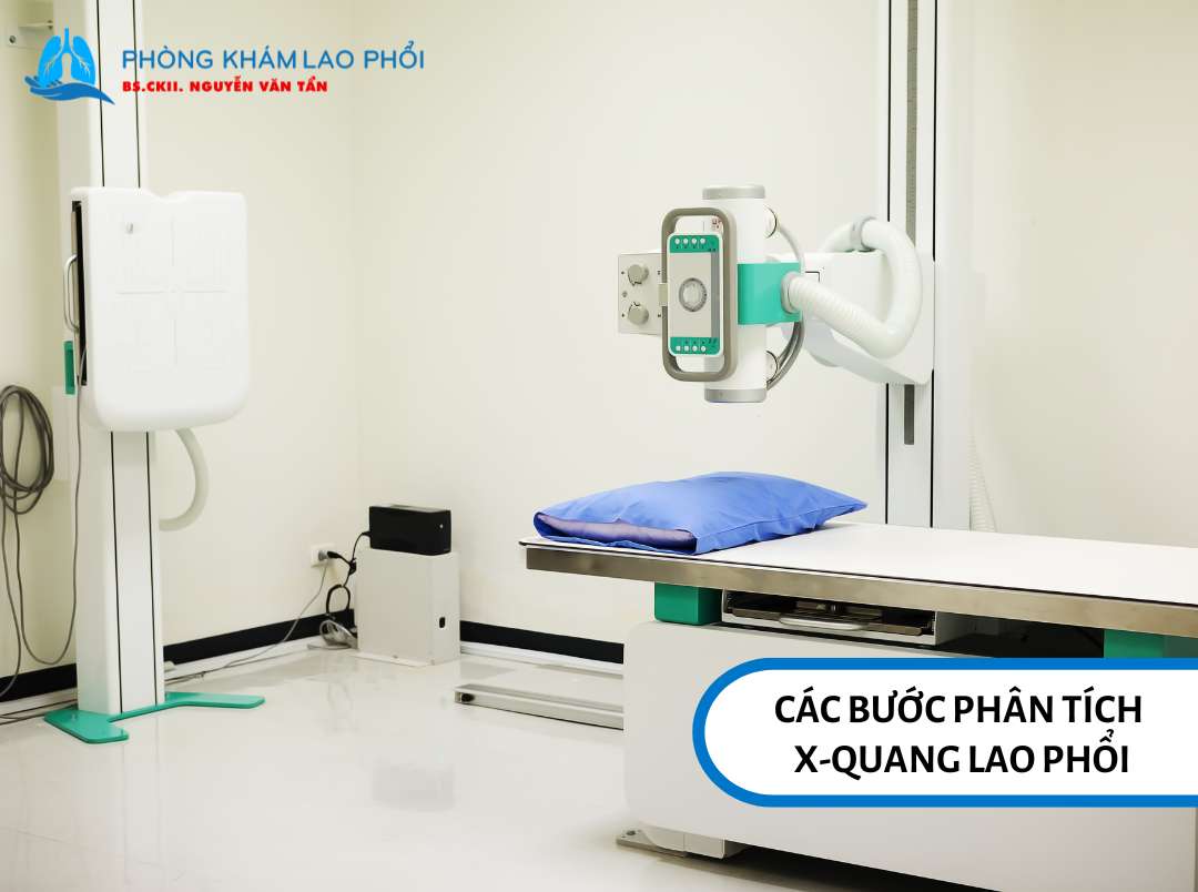 Các bước phân tích phim X-quang lao phổi
