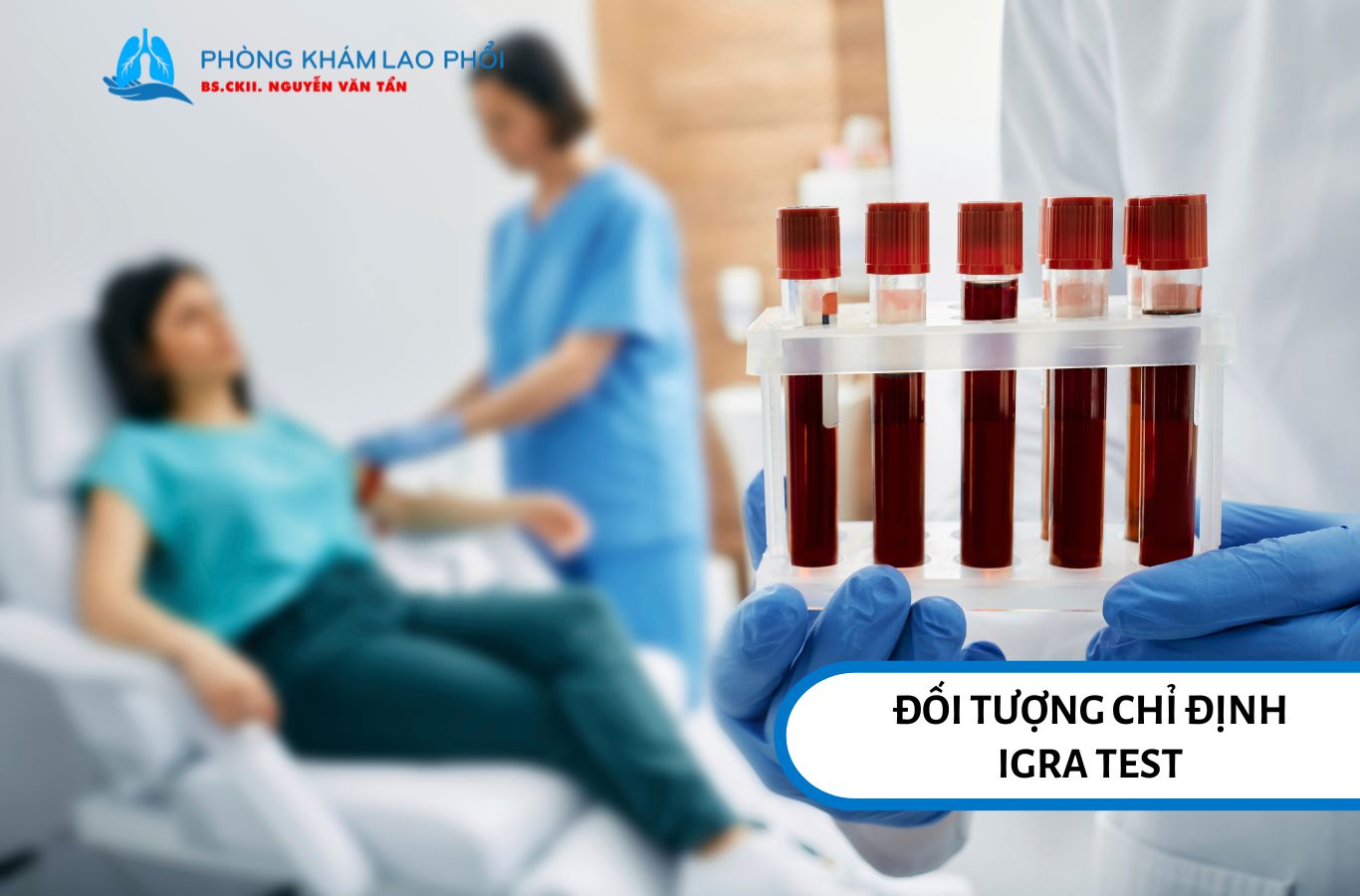 Đối tượng chỉ định IGRA test 