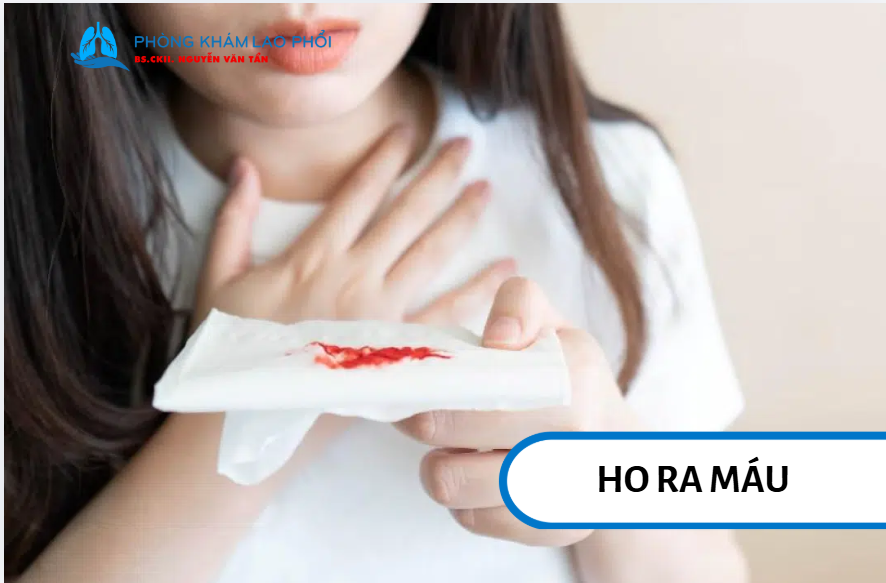 Lao phổi có thể gây biến chứng nặng nếu không điều trị kịp thời
