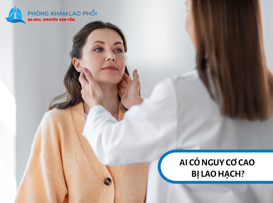 Nữ giới và người trẻ tuổi là đối tượng dễ mắc lao hạch