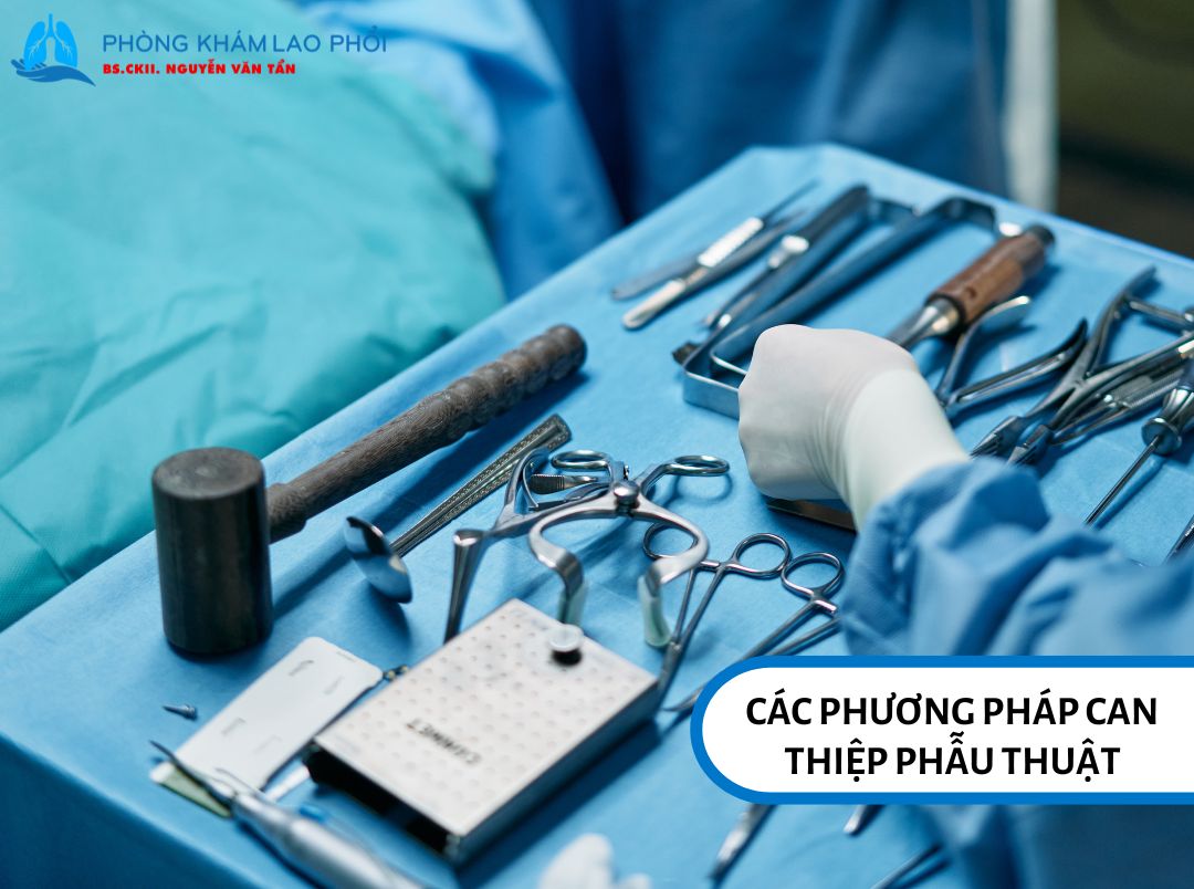 Các phương pháp can thiệp phẫu thuật điều trị lao hạch