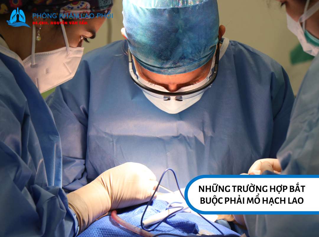 Những trường hợp bắt buộc phải mổ hạch lao