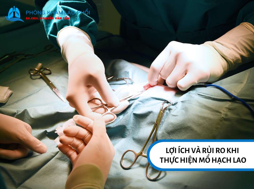 Lợi ích và rủi ro khi thực hiện mổ hạch lao