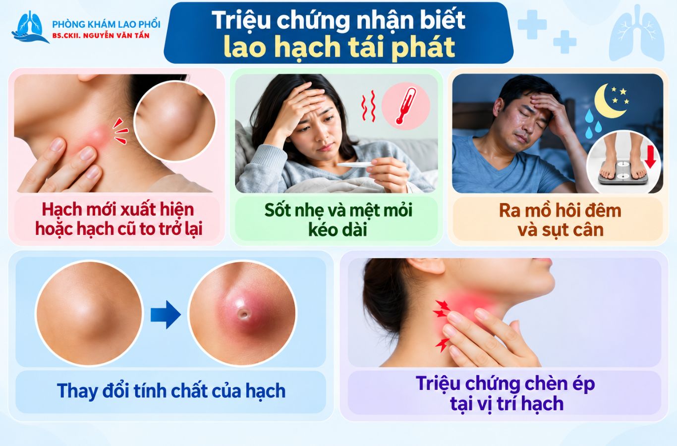 Lao hạch tái phát thường gây hạch to trở lại, sốt nhẹ và mệt mỏi