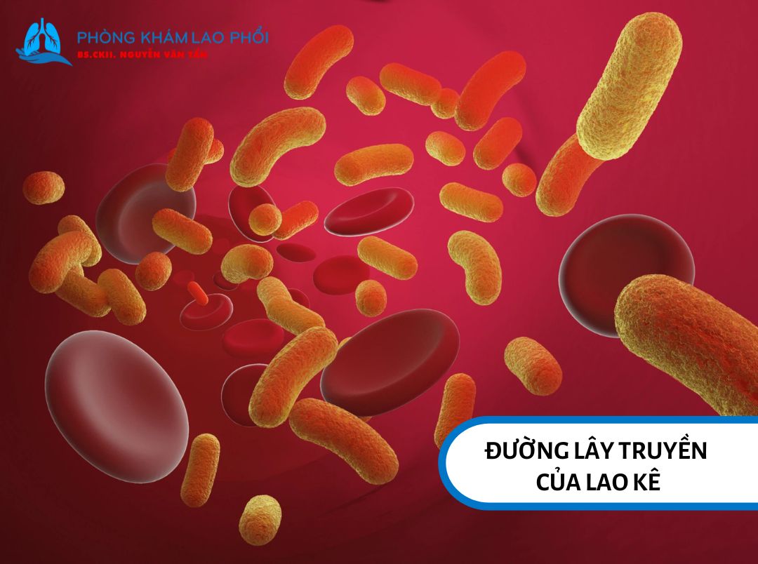 Lao kê lây truyền chủ yếu qua đường máu hoặc bạch huyết