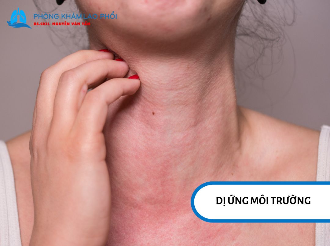 Bụi, phấn hoa, nấm mốc hay lông thú có thể kích thích đường thở và làm xuất hiện các triệu chứng hô hấp