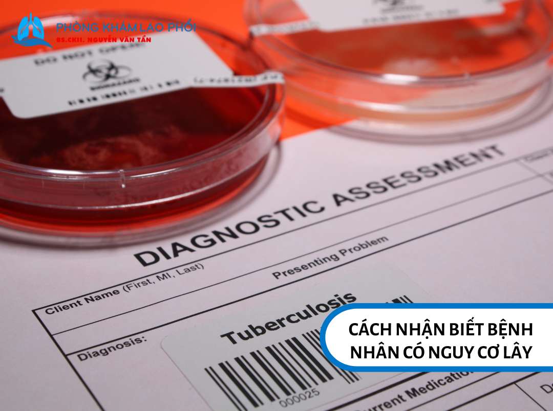 Nếu người bệnh lao màng phổi có kết quả cấy đờm dương tính thì có khả năng lây cho người khác