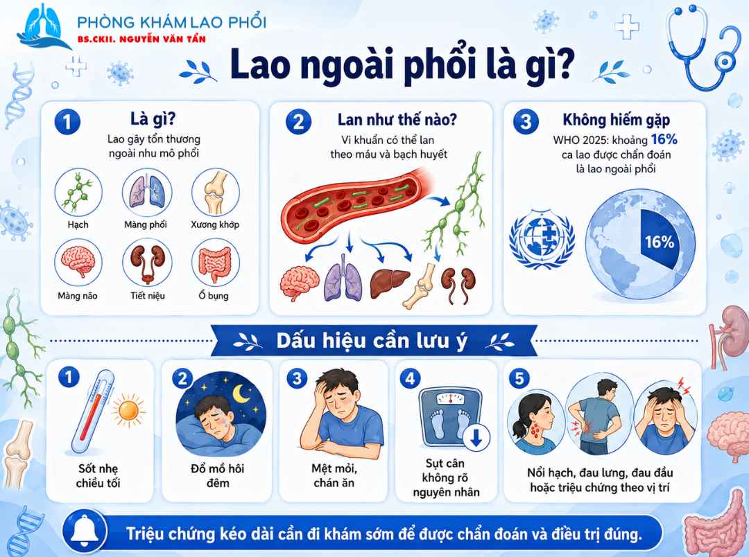Lao ngoài phổi có thể xuất hiện khi vi khuẩn lao lan theo máu, bạch huyết hoặc khi hệ miễn dịch suy yếu