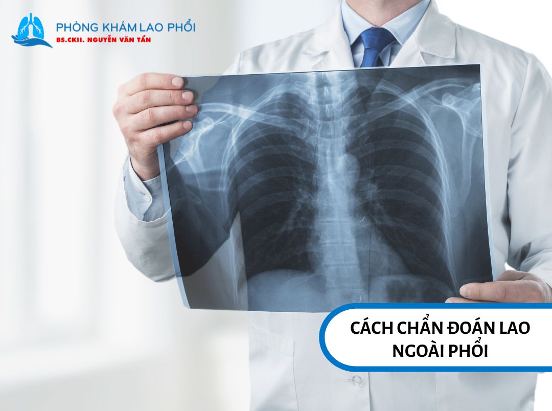 Cách chẩn đoán lao ngoài phổi