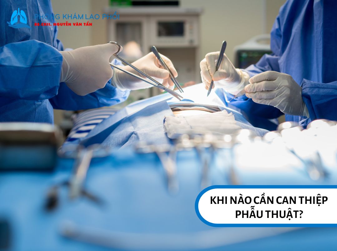 Phẫu thuật chỉ được chỉ định trong các trường hợp đặc biệt
