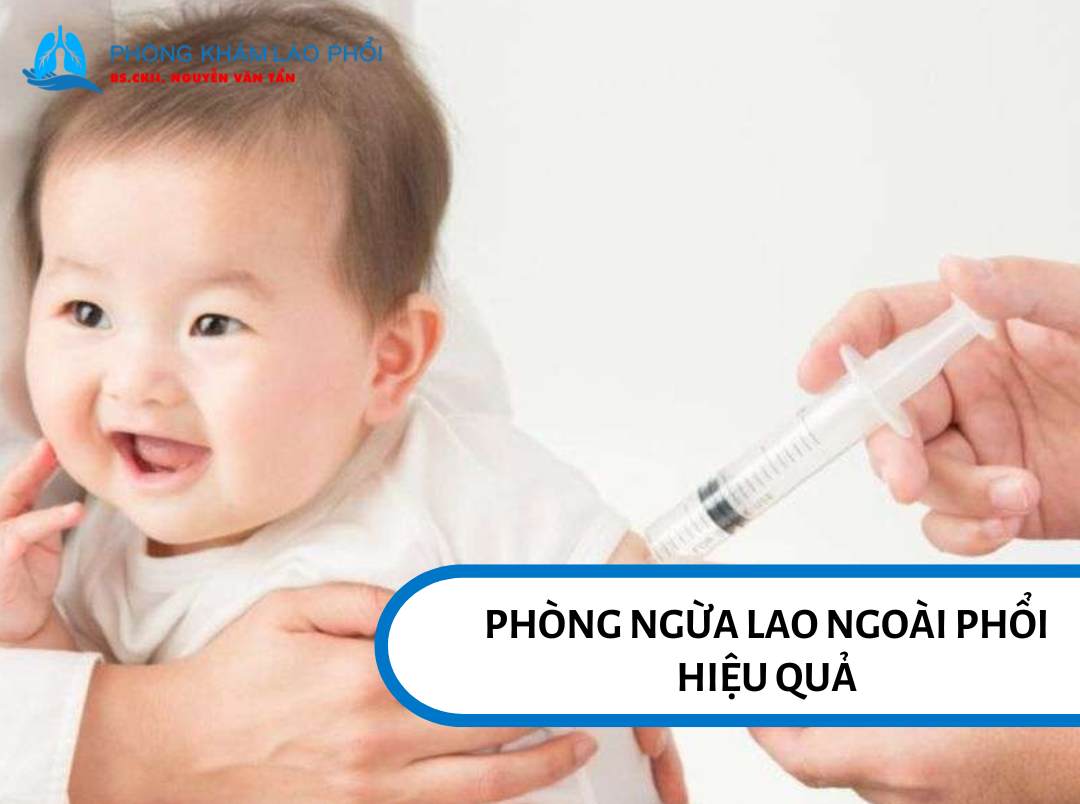 Tiêm vắc-xin BCG cho trẻ sơ sinh