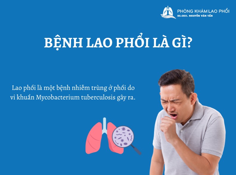 Tìm hiểu về bệnh lao phổi