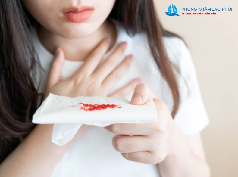 Ho ra máu là biểu hiện của bệnh lao phổi