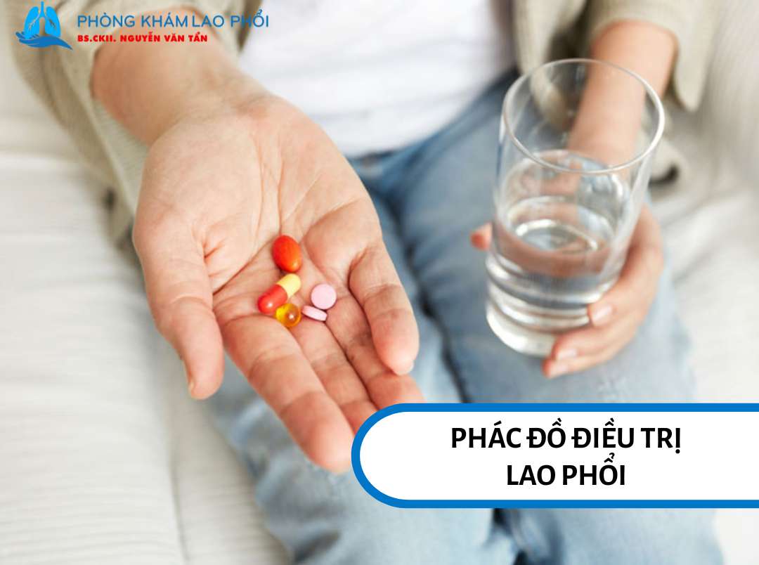 Phác đồ lao gồm 2 giai đoạn: Tấn công 4 thuốc để diệt nhanh vi khuẩn và duy trì 3 thuốc để ngừa tái phát