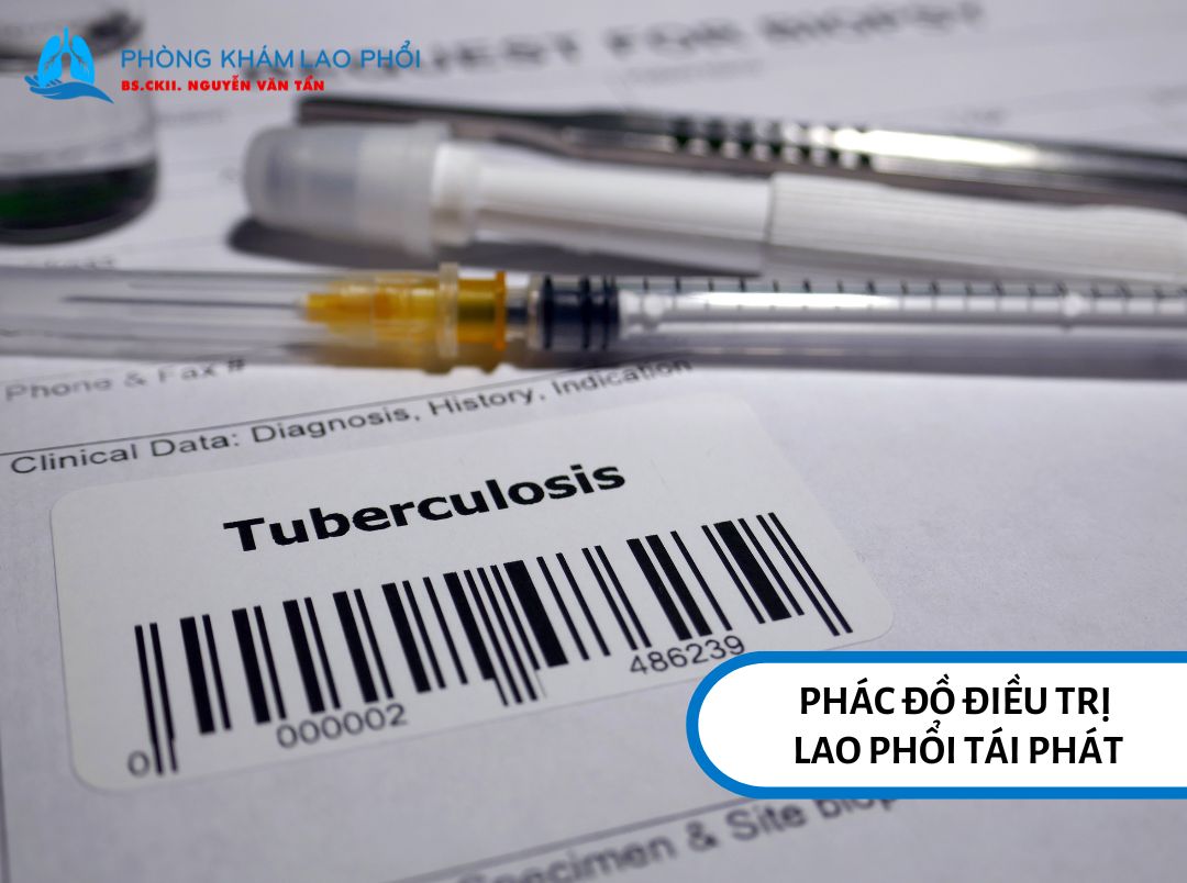 Các loại thuốc điều trị lao phổi
