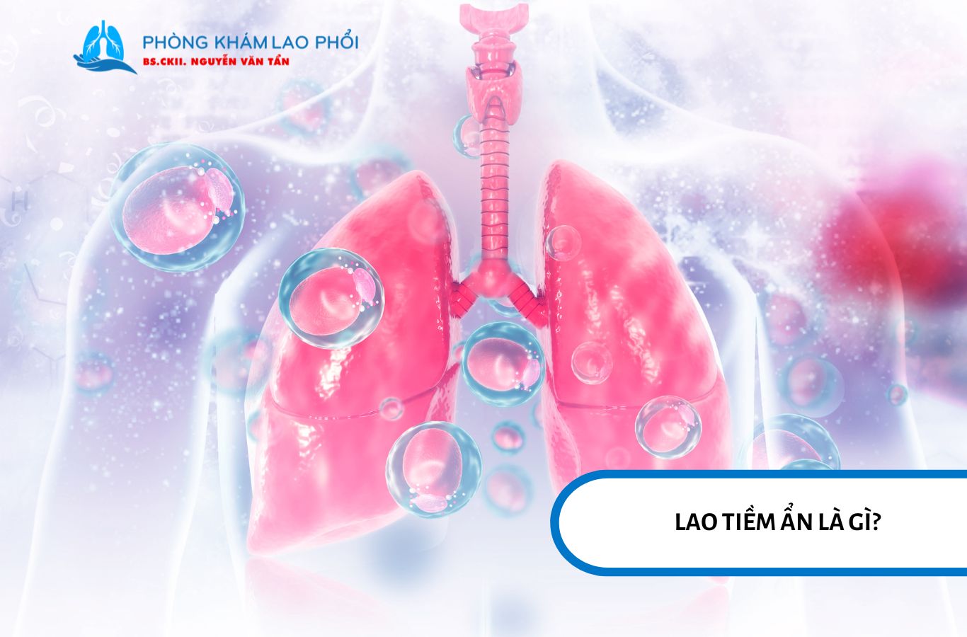 Lao tiềm ẩn là tình trạng vi khuẩn Mycobacterium tuberculosis đã xâm nhập vào cơ thể nhưng chưa gây ra bệnh lao hoạt động
