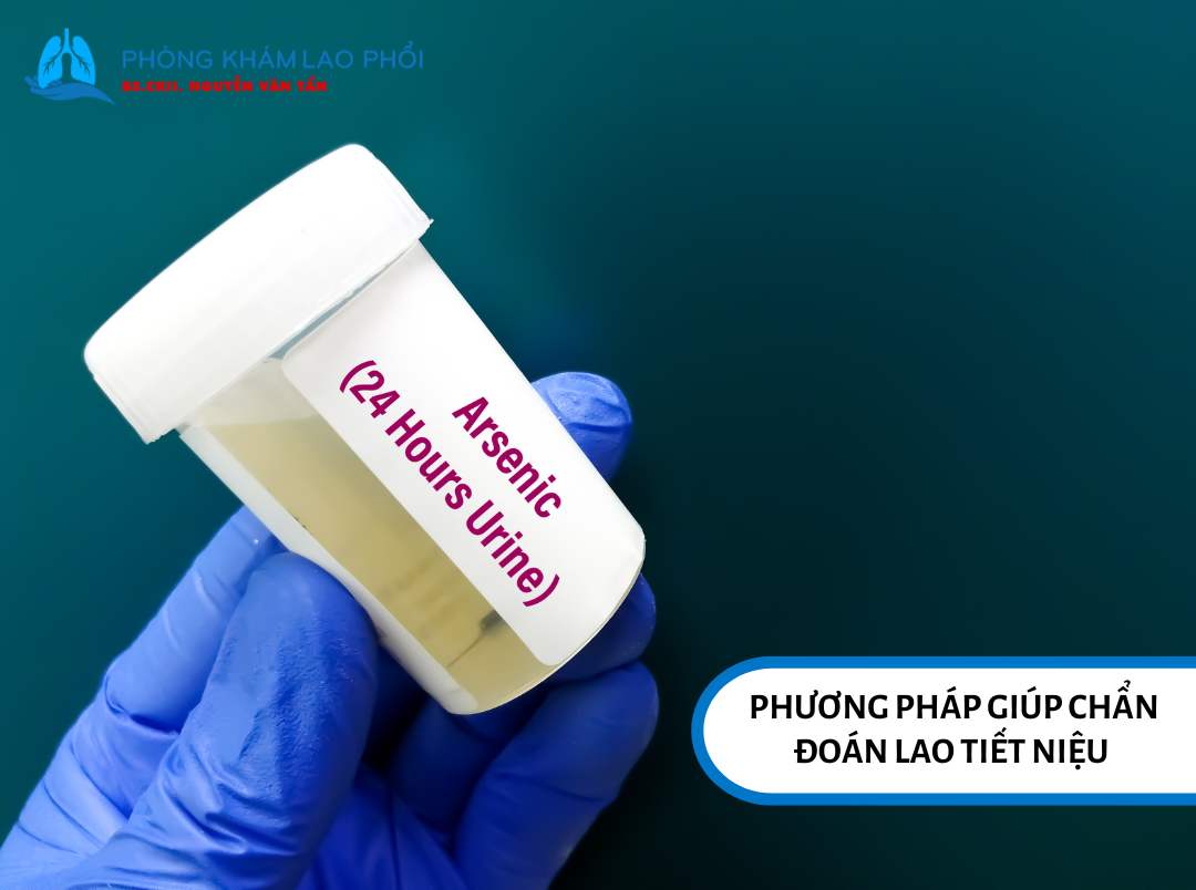Phương pháp giúp chẩn đoán lao tiết niệu chính xác