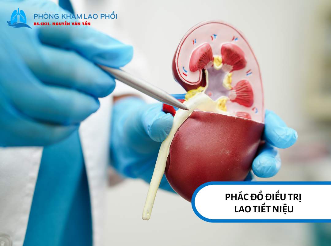 Phác đồ điều trị lao tiết niệu