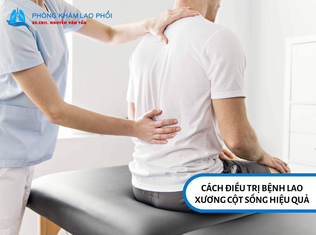 Cách điều trị bệnh lao xương cột sống hiệu quả