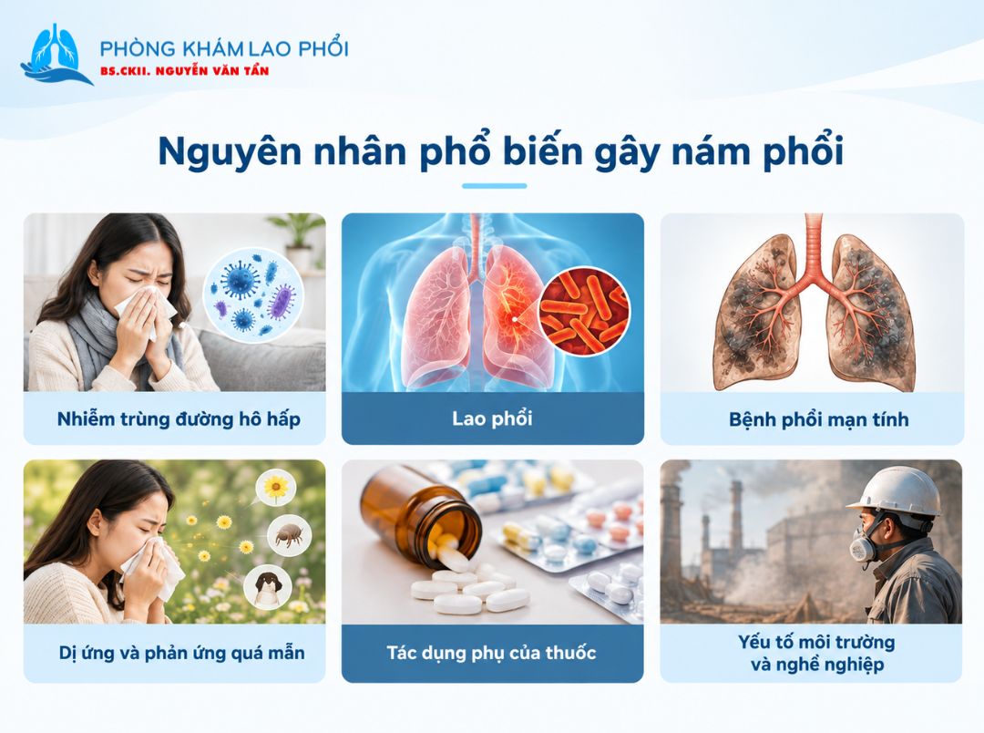 Nám phổi có thể do nhiễm trùng, bệnh phổi mạn tính, thuốc, dị ứng hoặc tiếp xúc với yếu tố môi trường 