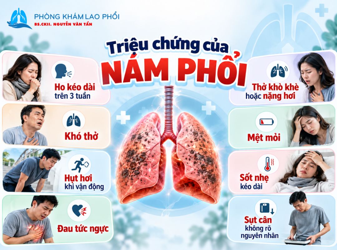 Nám phổi có thể gây ho kéo dài, khó thở, đau tức ngực, mệt mỏi, sốt nhẹ hoặc sụt cân không rõ nguyên nhân