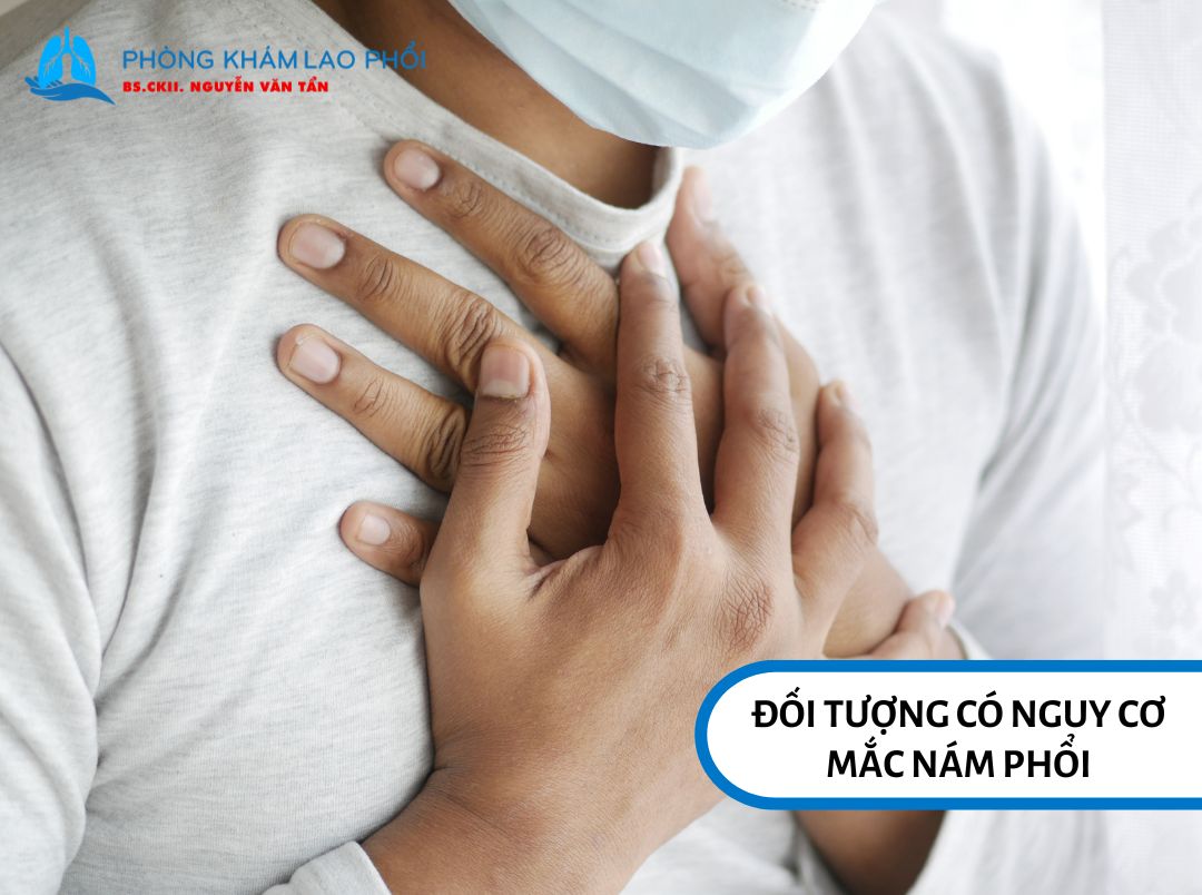 Người lớn tuổi, hút thuốc hoặc mắc bệnh phổi mạn tính có nguy cơ mắc nám phổi cao hơn 