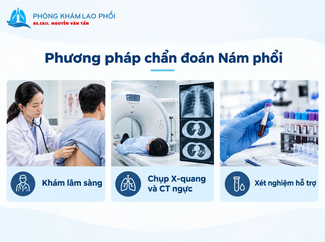 Chẩn đoán nám phổi dựa trên khám lâm sàng, chẩn đoán hình ảnh và xét nghiệm hỗ trợ